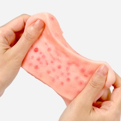 Pimple Popping Toy